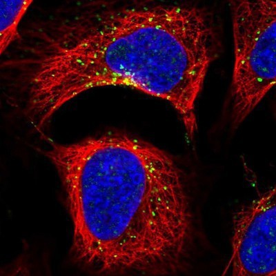 Immunocytochemistry/Immunofluorescence: Snx6 Antibody [NBP2-13361] - Staining of human cell line U-2 OS shows positivity in vesicles.