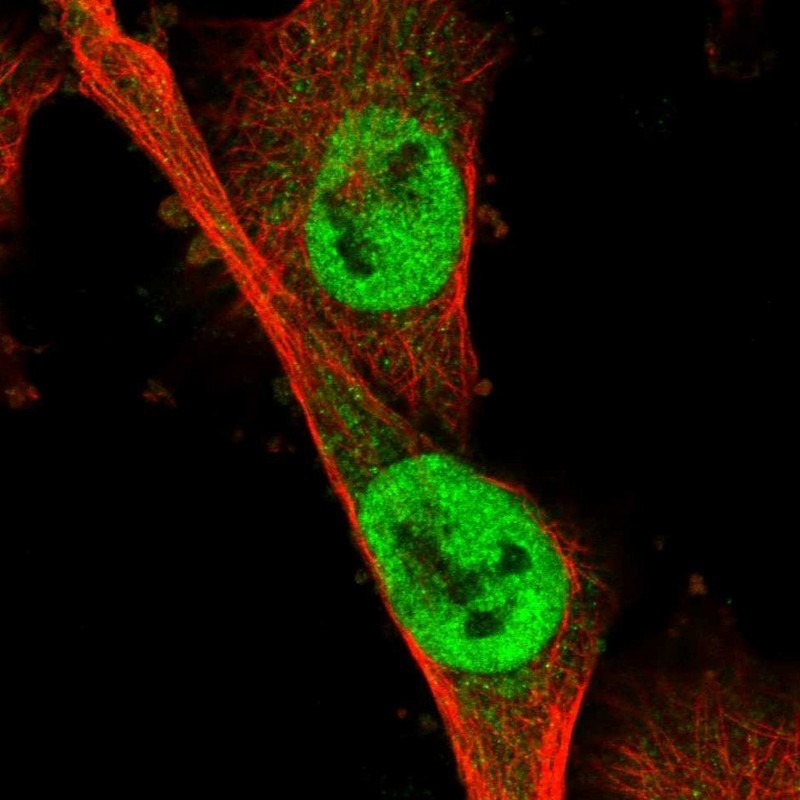 Immunocytochemistry/Immunofluorescence: NOTUM Antibody [NBP1-86003] - Immunofluorescent staining of human cell line U-251MG shows positivity in nuclei but not nucleoli.