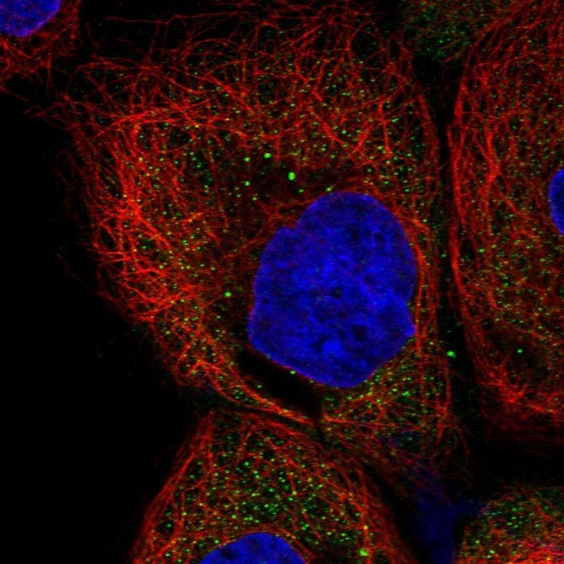 Immunocytochemistry/Immunofluorescence: NDRG3 Antibody [NBP1-86034] - Immunofluorescent staining of human cell line A-431 shows positivity in cytoplasm.