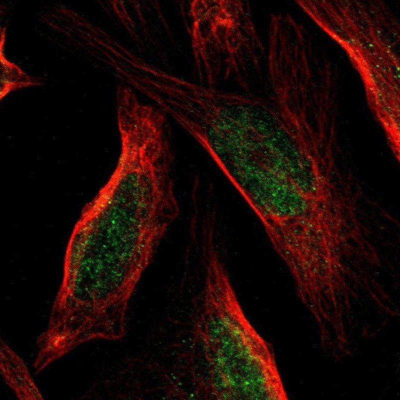 Immunocytochemistry/Immunofluorescence: ACSF3 Antibody [NBP1-86119] - Immunofluorescent staining of human cell line U-2 OS shows positivity in nucleus but not nucleoli.