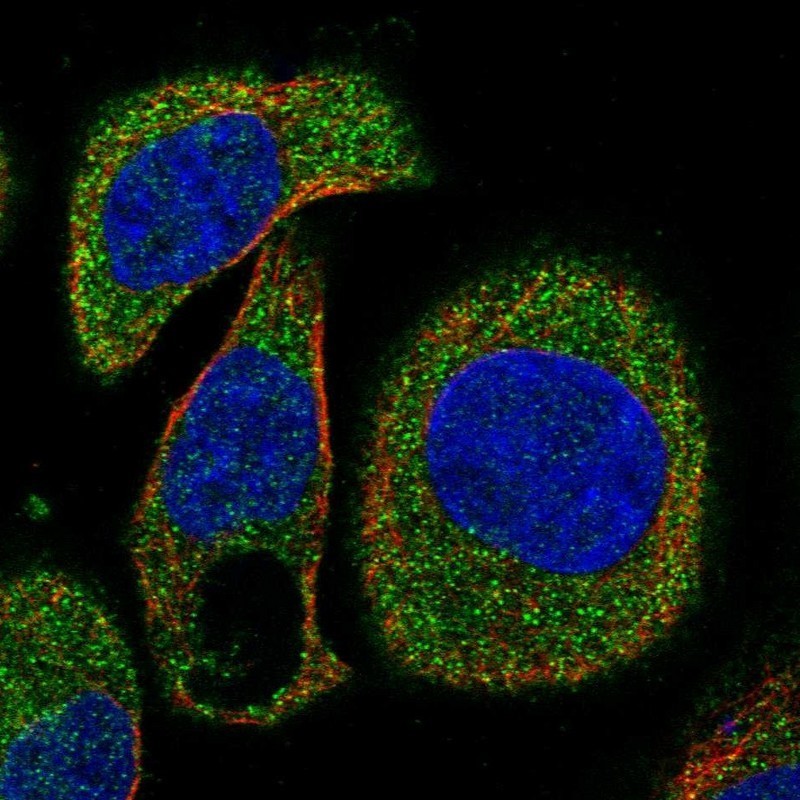 Immunocytochemistry/Immunofluorescence: OSTF1 Antibody [NBP2-13718] - Staining of human cell line A-431 shows positivity in cytoplasm.