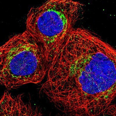 Immunocytochemistry/Immunofluorescence: DBT Antibody [NBP1-89522] - Staining of human cell line A-431 shows positivity in mitochondria.