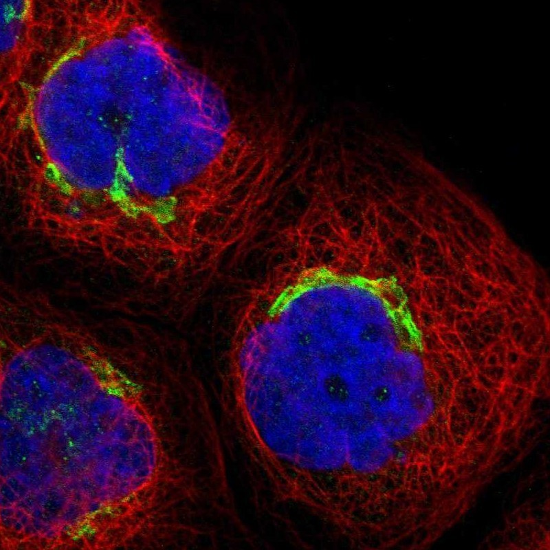 Immunocytochemistry/Immunofluorescence: PHACS Antibody [NBP1-90260] - Staining of human cell line A-431 shows positivity in golgi.