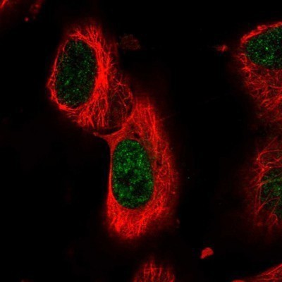 Immunocytochemistry/Immunofluorescence: FAAP100 Antibody [NBP1-90467] - Staining of human cell line U-251MG shows positivity in nucleus but not nucleoli.