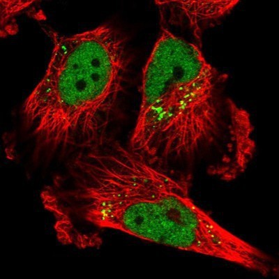 Immunocytochemistry/Immunofluorescence: MFSD8 Antibody [NBP1-92114] - Staining of human cell line U-251 MG shows positivity in nucleus but not nucleoli & vesicles.