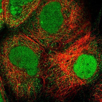 Immunocytochemistry/Immunofluorescence: RASGRP 4 Antibody [NBP1-92317] - Staining of human cell line A-431 shows positivity in nucleus & cytoplasm.