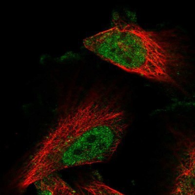 Immunocytochemistry/Immunofluorescence: LAS1L Antibody [NBP1-92066] - Staining of human cell line U-251 MG shows positivity in nucleus but not nucleoli.