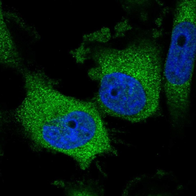 Immunocytochemistry/Immunofluorescence: LYPLAL1 Antibody [NBP1-92090] - Staining of human cell line U-251 MG shows positivity in cytoplasm.