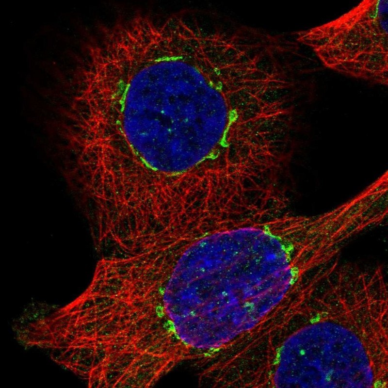 Immunocytochemistry/Immunofluorescence: HPS3 Antibody [NBP1-92007] - Staining of human cell line A-431 shows positivity in golgi apparatus.