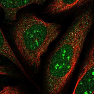 Immunocytochemistry/Immunofluorescence: IP6K1 Antibody [NBP1-92026] - Staining of human cell line U-2 OS shows positivity in nucleoli.