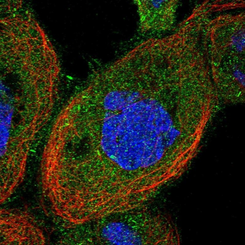 Immunocytochemistry/Immunofluorescence: METTL21C Antibody [NBP1-92111] - Staining of human cell line A-431 shows positivity in cytoplasm & focal adhesions.