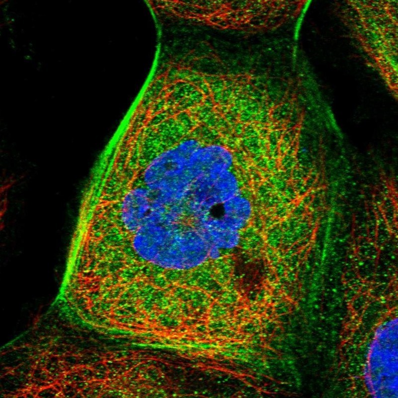 Immunocytochemistry/Immunofluorescence: FLJ14154 Antibody [NBP1-91904] - Staining of human cell line A-431 shows positivity in cytoplasm & cytoskeleton (actin filaments).