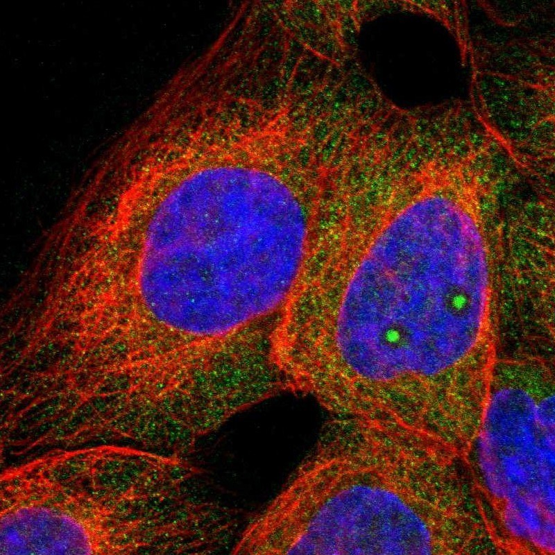 Immunocytochemistry/Immunofluorescence: C1orf159 Antibody [NBP1-93971] - Staining of human cell line A-431 shows positivity in nucleoli & cytoplasm.