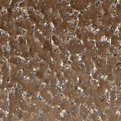 Immunohistochemistry-Paraffin: C1orf159 Antibody [NBP1-93971] - Staining of human liver shows strong nuclear and cytoplasmic positivity in hepatocytes.