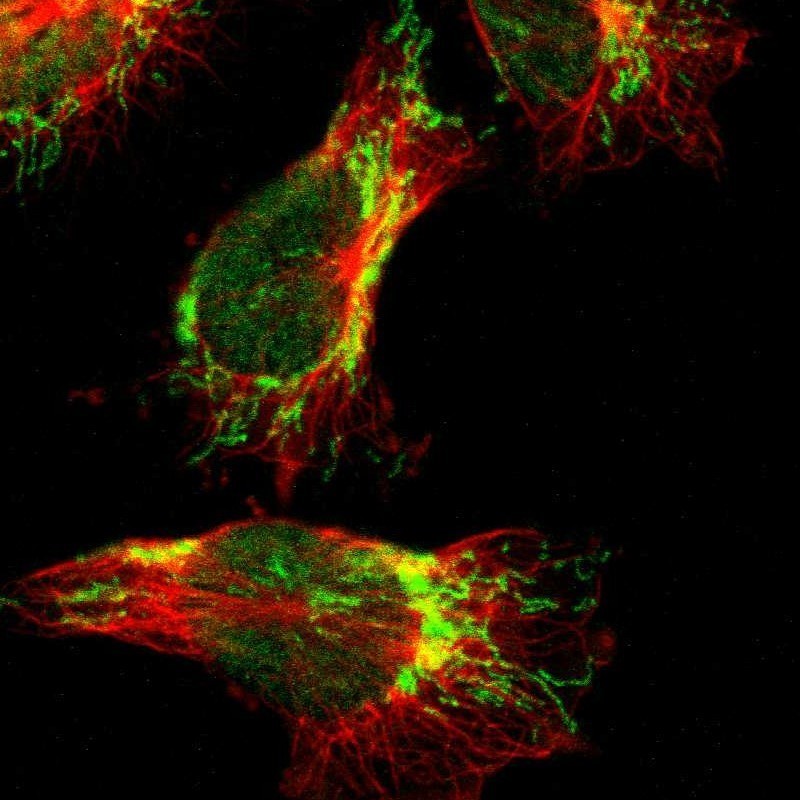 Immunocytochemistry/Immunofluorescence: AFAP1L1 Antibody [NBP1-93812] - Staining of human cell line U-251MG shows positivity in nucleus but not nucleoli & mitochondria.