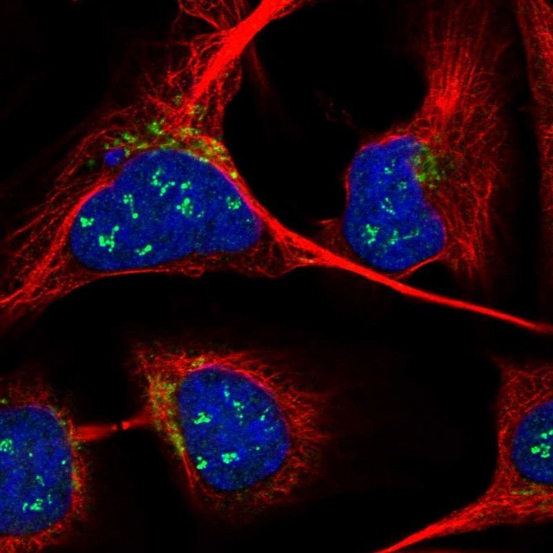 Immunocytochemistry/Immunofluorescence: ANKRD40 Antibody [NBP1-93516] - Staining of human cell line U-2 OS shows positivity in nucleoli & golgi apparatus.