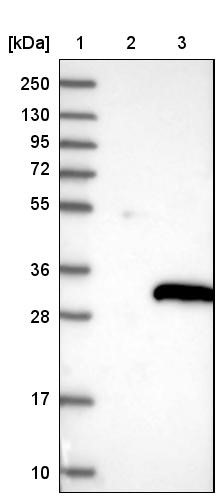 Western Blot: C22orf13 Antibody [NBP1-93512] - Lane 1: Marker [kDa] 250, 130, 95, 72, 55, 36, 28, 17, 10<br/>Lane 2: Negative control (vector only transfected HEK293T lysate)<br/>Lane 3: Over-expression lysate (Co-expressed with a C-terminal myc-DDK tag (~3.1 kDa) in mammalian HEK293T cells, LY410517)