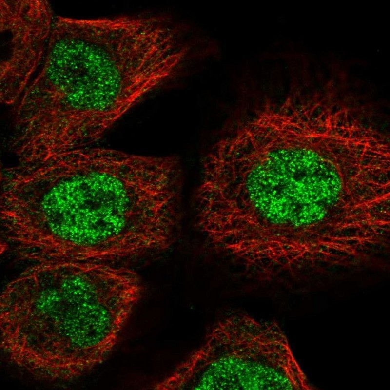 Immunocytochemistry/Immunofluorescence: C22orf13 Antibody [NBP1-93512] - Staining of human cell line A-431 shows positivity in nucleus but not nucleoli.