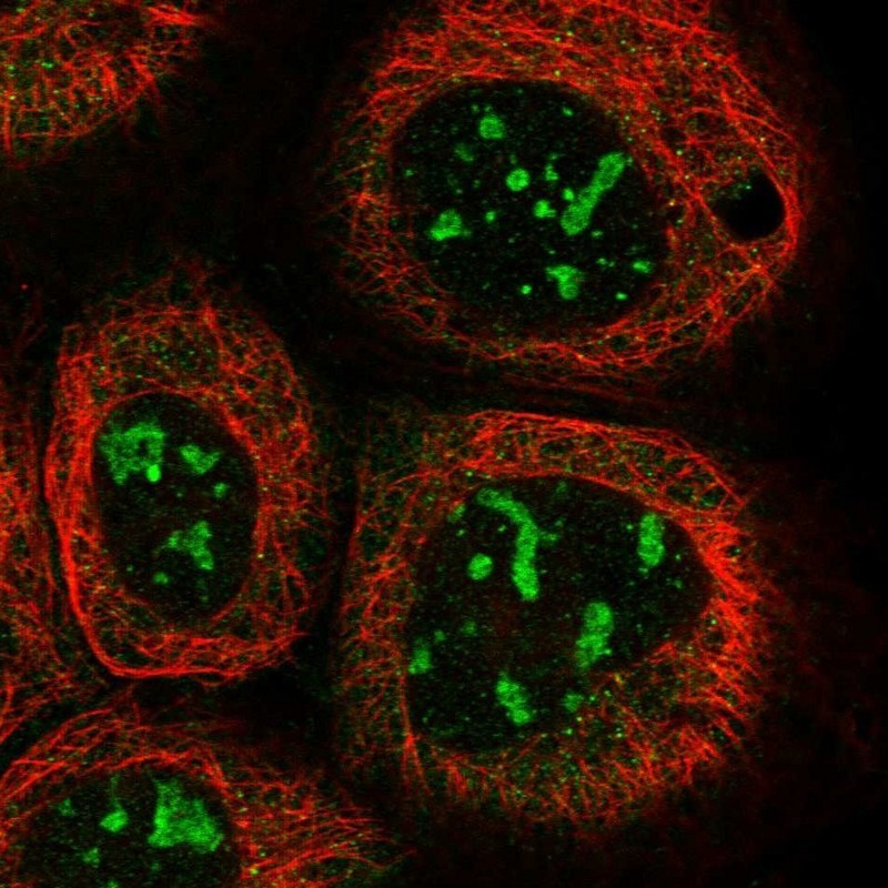 Immunocytochemistry/Immunofluorescence: KRT80 Antibody [NBP1-93662] - Staining of human cell line A-431 shows positivity in nucleoli.