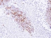 Immunohistochemistry-Paraffin: EPH Receptor A8 Antibody [NBP1-32864] - Paraffin-embedded H520 xenograft, using EPH receptor A8 antibody at 1:500 dilution.