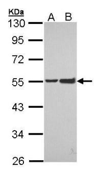 Western Blot: EPH Receptor A8 Antibody [NBP1-32864] - (30 ug of whole cell lysate) A: Hep G2  B: Molt-4 10% SDS PAGE diluted at 1:1000