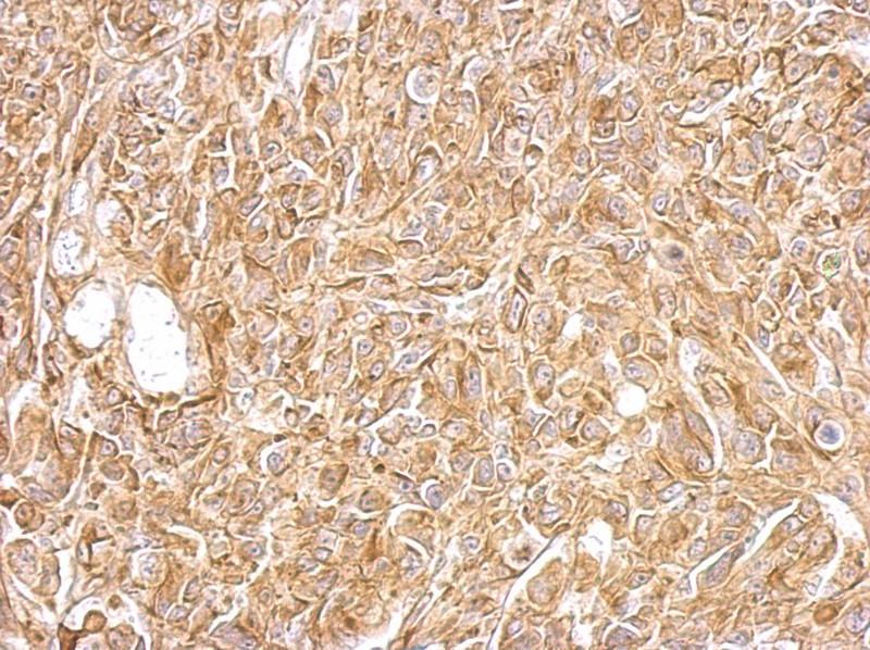 Immunohistochemistry-Paraffin: EPH Receptor A8 Antibody [NBP1-32864] - Paraffin-embedded SkHep1 xenograft; antibody dilution 1:500.