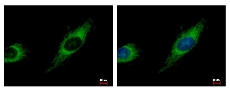 Immunocytochemistry/Immunofluorescence: TBRG4 Antibody [NBP2-20582] - Sample: HeLa cells were fixed in 4% paraformaldehyde at RT for 15 min. Green: TBRG4 protein stained by TBRG4 antibody diluted at 1:500. Blue: Hoechst 33343 staining.