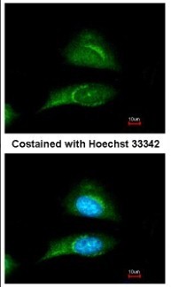 Immunocytochemistry/Immunofluorescence: SKIP Antibody [NBP2-20379] - Immunofluorescence analysis of methanol-fixed HeLa, using antibody at 1:200 dilution.