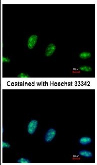Immunocytochemistry/Immunofluorescence: RRP1 Antibody [NBP2-20233] - Immunofluorescence analysis of paraformaldehyde-fixed HeLa, using antibody at 1:500 dilution.