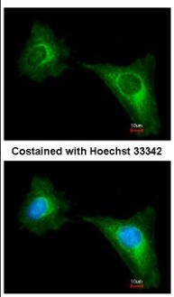 Immunocytochemistry/Immunofluorescence: Wnt10b Antibody [NBP2-20907] - Immunofluorescence analysis of methanol-fixed HeLa, using antibody at 1:500 dilution.