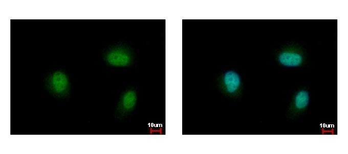 Immunocytochemistry/Immunofluorescence: Myt1 Antibody [NBP2-19456] - Sample: HeLa cells were fixed in 4% paraformaldehyde at RT for 15 min. Green: MYT1 protein stained by MYT1 antibody diluted at 1:500. Blue: Hoechst 33342 staining.