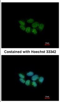 Immunocytochemistry/Immunofluorescence: PHACTR3 Antibody [NBP2-19791] - Immunofluorescence analysis of paraformaldehyde-fixed A431, using antibody at 1:200 dilution.