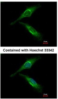 Immunocytochemistry/Immunofluorescence: ARFGAP2 Antibody [NBP2-15441] - Analysis of methanol-fixed HeLa, using antibody at 1:500 dilution.