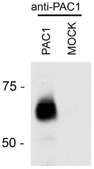 Western Blot: PACAP Receptor Antibody [NBP1-49570]