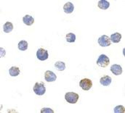 Immunocytochemistry/Immunofluorescence: TSC2 Antibody [NBP1-76619] - L1210 cells with TSC2 antibody at 10 ug/ml.