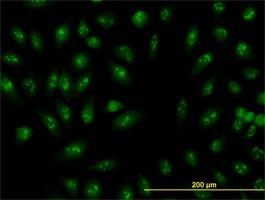 Immunocytochemistry/Immunofluorescence: RRP9 Antibody (1E8) [H00009136-M01] - Immunofluorescence of monoclonal antibody to RNU3IP2 on HeLa cell . [antibody concentration 10 ug/ml]