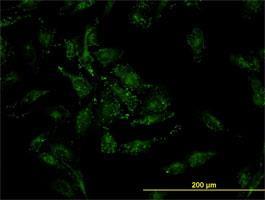 Immunocytochemistry/Immunofluorescence: Cofilin 2 Antibody (6G9) [H00001073-M03] - of monoclonal antibody to CFL2 on HeLa cell . [antibody concentration 10 ug/ml]