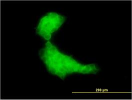 Immunocytochemistry/Immunofluorescence: DNAJB2 Antibody (2C9) [H00003300-M03] - Immunofluorescence of monoclonal antibody to DNAJB2 (H00003300-M03) on A-431 cell . [antibody concentration 10 ug/ml]