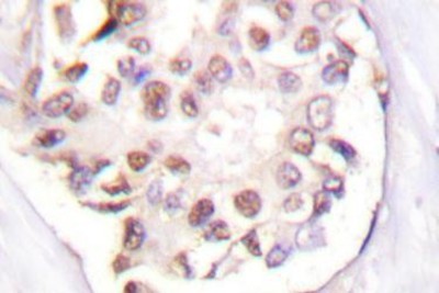 Immunohistochemistry-Paraffin: Retinoid X Receptor gamma Antibody [NB100-91953] - Human lymph node breast carcinoma tonsil tissue.
