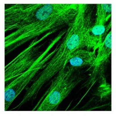 Immunocytochemistry/Immunofluorescence: ASTN2 Antibody [NBP1-59195] - Human Fibroblasts at a 1:100 dilution.