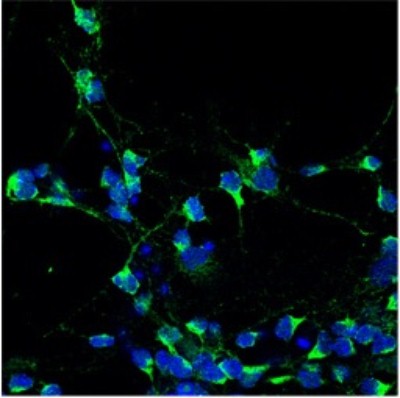 Immunocytochemistry/Immunofluorescence: ASTN2 Antibody [NBP1-59195] - Mouse Cerebellar Granule Cells at a 1:100 dilution.