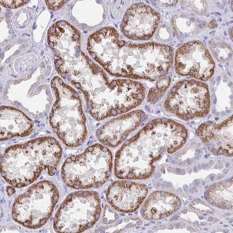 Immunohistochemistry: Importin-9 Antibody [NBP2-31588] - Immunohistochemical staining of human kidney shows strong cytoplasmic positivity in cells in tubules.