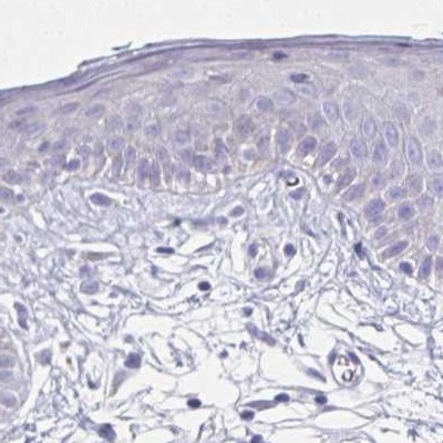 Immunohistochemistry: Importin-9 Antibody [NBP2-31588] - skin