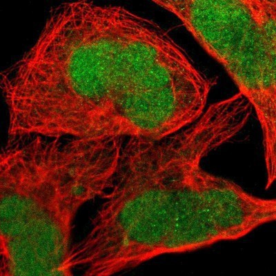 Immunocytochemistry/Immunofluorescence: JPH1 Antibody [NBP1-83075] - Staining of human cell line A-431 shows positivity in nucleus.