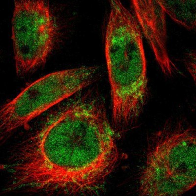 Immunocytochemistry/Immunofluorescence: HKDC1 Antibody [NBP1-82108] - Staining of human cell line U-251 MG shows positivity in nucleus but not nucleoli & mitochondria.