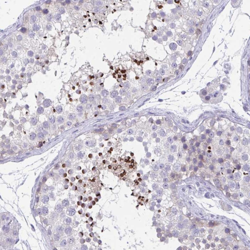 Immunohistochemistry: C7orf61 Antibody [NBP2-32540] - Immunohistochemical staining of human testis shows strong cytoplasmic positivity in cells in a subset of cells in seminiferus ducts.
