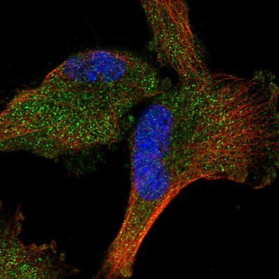 Immunocytochemistry/Immunofluorescence: Phosducin Antibody [NBP1-87773] - Staining of human cell line U-251MG shows positivity in cytoplasm.