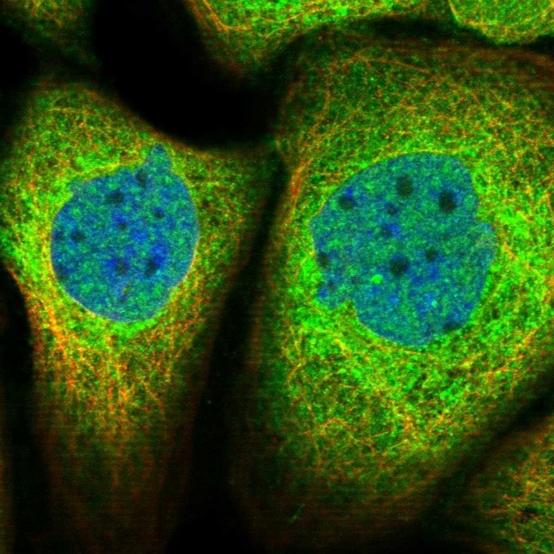 Immunocytochemistry/Immunofluorescence: MED8 Antibody [NBP1-89015] - Staining of human cell line A-431 shows positivity in nucleus but not nucleoli & cytoplasm.