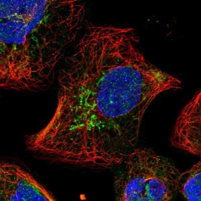 Immunocytochemistry/Immunofluorescence: SLC25A22 Antibody [NBP1-84880] - Staining of human cell line A-431 shows positivity in nucleus but not nucleoli & mitochondria.