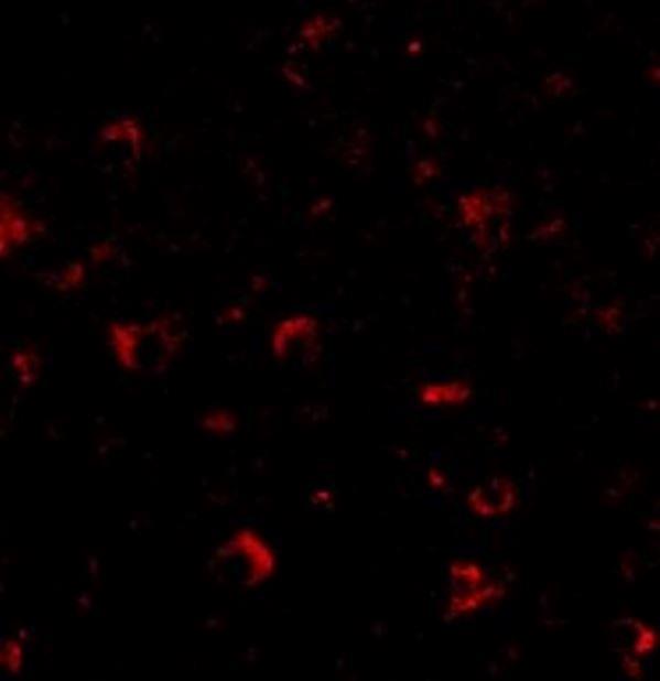 Immunocytochemistry/Immunofluorescence: AMBRA1 Antibody [NBP1-76894] - Human Brain cells.